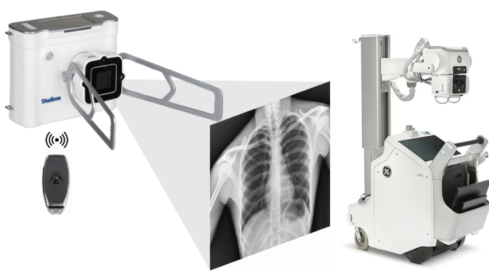 Portable X ray machine for sale in UAE with digital radiography imaging